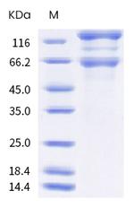 SARS-CoV-2 Spike Protein S1/S2 (B.1.618) His-tag Protein