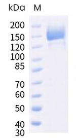 SARS-CoV-2 Spike Protein S1/S2 (BA.5) His-tag Protein