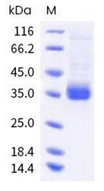 SARS-CoV-2 Spike Protein (RBD) (BA.2.9.1; BA.2.13) His-tag Protein