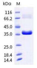 Monkeypox Virus I1L His-tag Protein