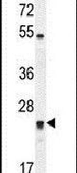 DPCD Antibody in Western Blot (WB)