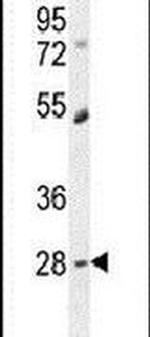 DPCD Antibody in Western Blot (WB)