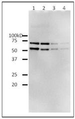 HIV1 Reverse Transcriptase Protein in Western blot control (WB Ctrl)