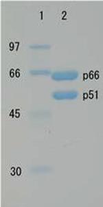 HIV1 Reverse Transcriptase Protein in Western blot control (WB Ctrl)
