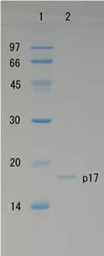 HIV1 p17 Protein in Western blot control (WB Ctrl)