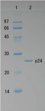 HIV1 p24 Protein in Western blot control (WB Ctrl)