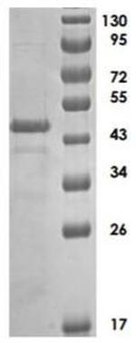 Human ADAMTS5 Protein