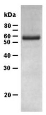 Human MMP-13 Protein
