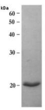 Human MMP-14 (Catalytic Domain) Protein