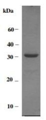 Human MMP-14 (Prodomain-catalytic Domain) Protein