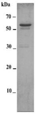 Human MMP-14 (Prodomain-catalytic domain-hemopexin domain) His-tag Protein