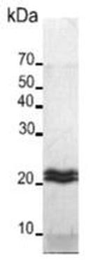 Human MMP-24 Protein