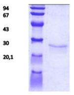 Human TIMP1 Protein