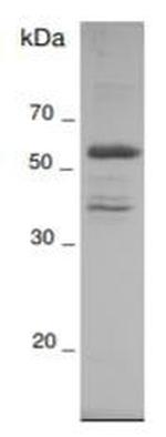 Human HTRA1 Protein
