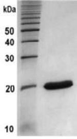 Human MMP-13 Protein