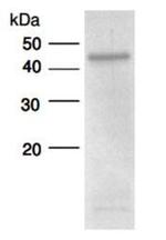 Human ADAMTS4 Protein