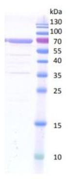Human MMP-2 Protein
