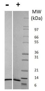 Human CCL2 (MCP-1) Protein