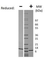 Human CCL13 (MCP-4) Protein