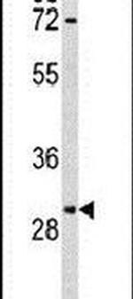 RPA2 Antibody in Western Blot (WB)