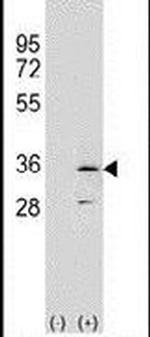 RPA2 Antibody in Western Blot (WB)