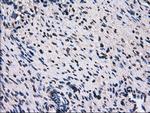 RPA2 Antibody in Immunohistochemistry (Paraffin) (IHC (P))