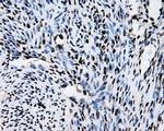 RPA2 Antibody in Immunohistochemistry (Paraffin) (IHC (P))
