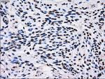 RPA2 Antibody in Immunohistochemistry (Paraffin) (IHC (P))