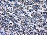 RPA2 Antibody in Immunohistochemistry (Paraffin) (IHC (P))