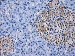 RPA2 Antibody in Immunohistochemistry (Paraffin) (IHC (P))