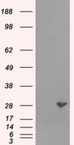 RPA2 Antibody in Western Blot (WB)