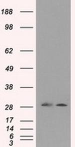 RPA2 Antibody in Western Blot (WB)