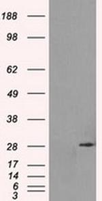 RPA2 Antibody in Western Blot (WB)