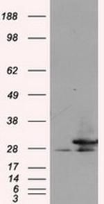 RPA2 Antibody in Western Blot (WB)