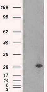 RPA2 Antibody in Western Blot (WB)