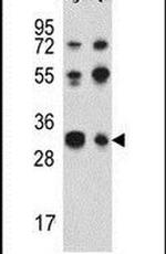 TWISTNB Antibody in Western Blot (WB)