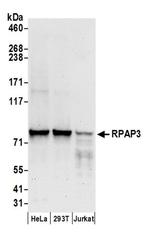 RPAP3 Antibody in Western Blot (WB)