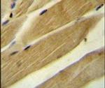 RPH3AL Antibody in Immunohistochemistry (IHC)