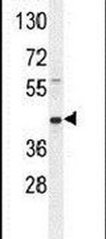 RPH3AL Antibody in Western Blot (WB)