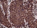 RPL10A Antibody in Immunohistochemistry (Paraffin) (IHC (P))