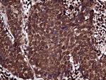RPL10A Antibody in Immunohistochemistry (Paraffin) (IHC (P))