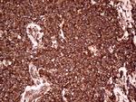RPL10A Antibody in Immunohistochemistry (Paraffin) (IHC (P))