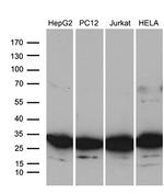 RPL10A Antibody in Western Blot (WB)