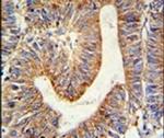 RPL17 Antibody in Immunohistochemistry (IHC)