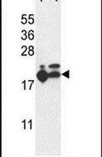 RPL17 Antibody in Western Blot (WB)