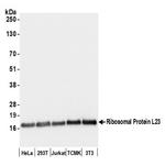 Ribosomal Protein L23/RPL23 Antibody in Western Blot (WB)
