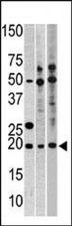 RPL23A Antibody in Western Blot (WB)