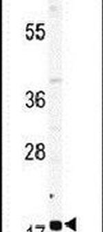 RPL23A Antibody in Western Blot (WB)