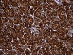 RPL27 Antibody in Immunohistochemistry (Paraffin) (IHC (P))