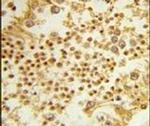 RPL31 Antibody in Immunohistochemistry (IHC)